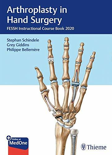 Arthroplasty in Hand Surgery: Fessh Instructional Course Book 2020 (Hardcover)