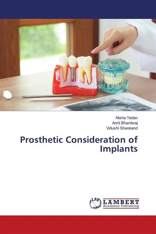 Prosthetic Consideration of Implants (Paperback)