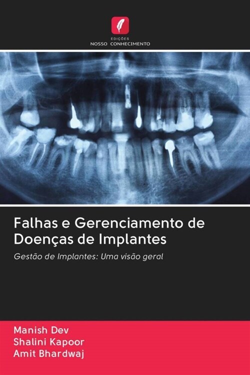 Falhas e Gerenciamento de Doencas de Implantes (Paperback)