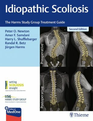 Idiopathic Scoliosis: The Harms Study Group Treatment Guide (Hardcover, 2)
