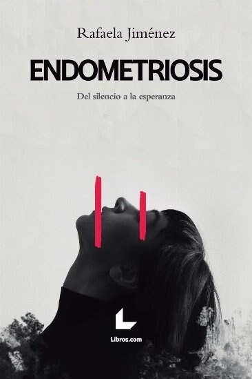 ENDOMETRIOSIS (Fold-out Book or Chart)