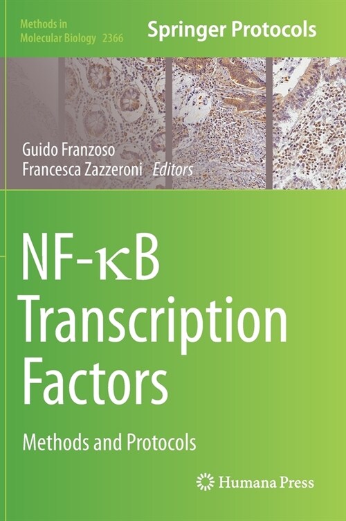 Nf-κb Transcription Factors: Methods and Protocols (Hardcover, 2021)