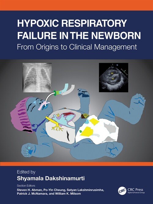 Hypoxic Respiratory Failure in the Newborn : From Origins to Clinical Management (Hardcover)