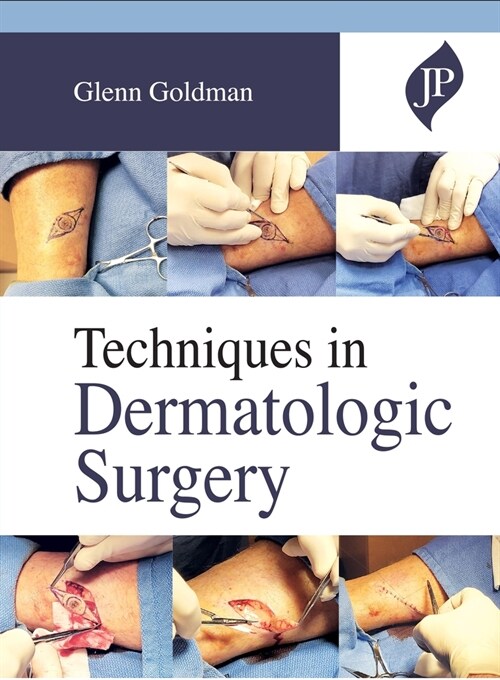 Techniques in Dermatologic Surgery (Hardcover, 1)