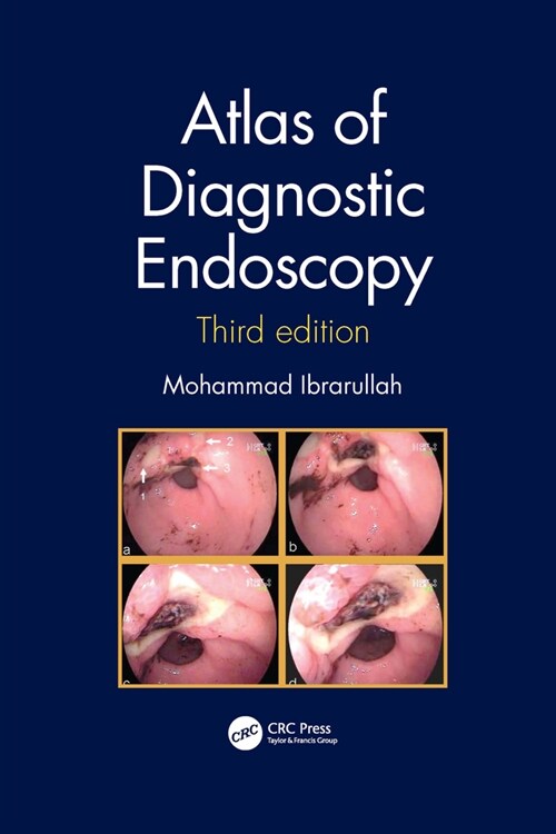 Atlas of Diagnostic Endoscopy, 3E (Paperback, 3 ed)