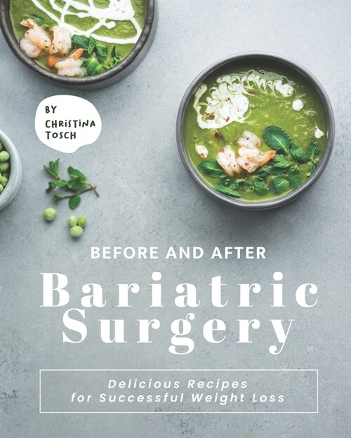 Before and After Bariatric Surgery: Delicious Recipes for Successful Weight Loss (Paperback)
