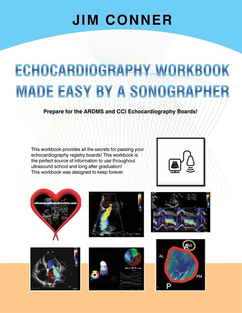 Echocardiography Workbook: Echocardiography Made Easy By A Sonographer (Paperback)