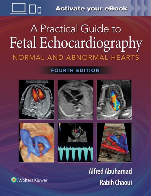 A Practical Guide to Fetal Echocardiography: Normal and Abnormal Hearts (Hardcover, 4th)