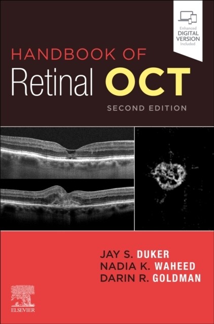 Handbook of Retinal Oct: Optical Coherence Tomography (Paperback, 2)