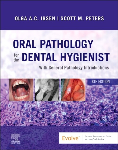 Oral Pathology for the Dental Hygienist (Hardcover, 8)