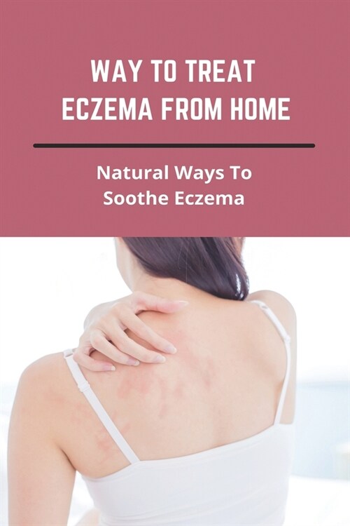 Way To Treat Eczema From Home: Natural Ways To Soothe Eczema: How To Treat Eczema Through Diet (Paperback)
