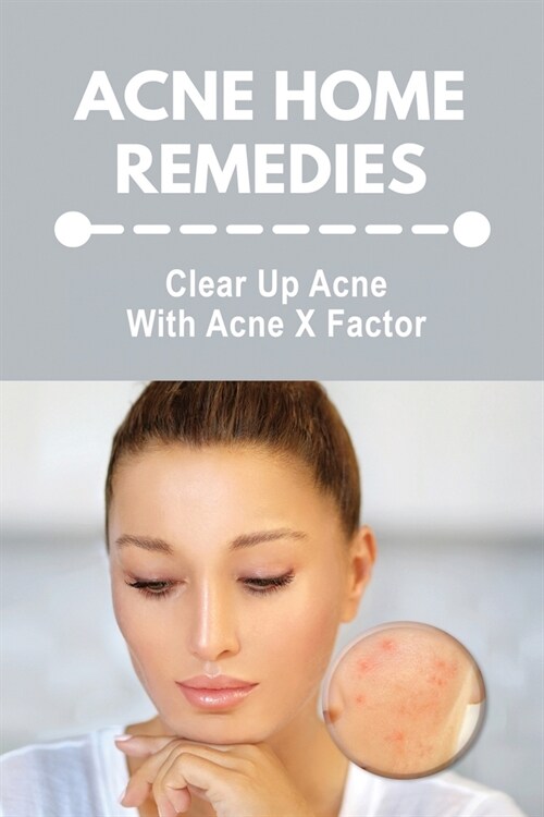 Acne Home Remedies: Clear Up Acne With Acne X Factor: Hormonal Acne (Paperback)