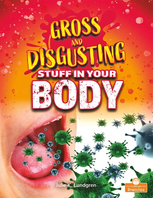 Gross and Disgusting Stuff in Your Body (Library Binding)