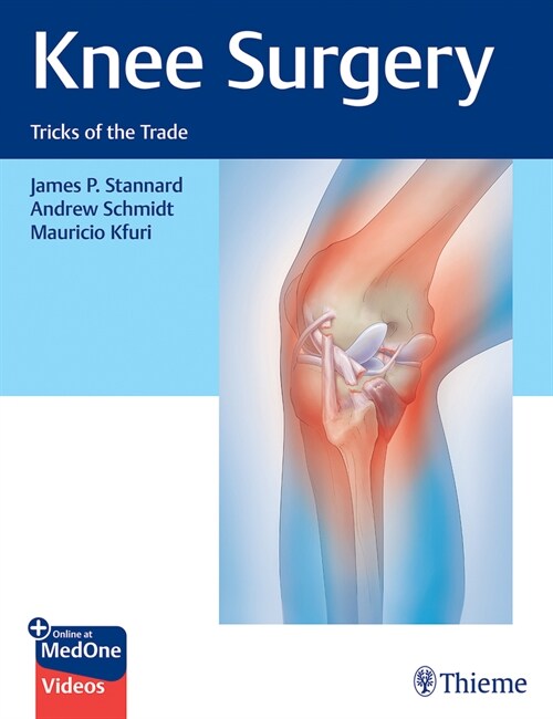 Knee Surgery: Tricks of the Trade (Hardcover)