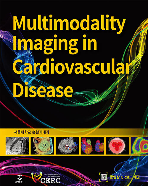 [중고] Multimodality Imaging in Cardiovascular Disease