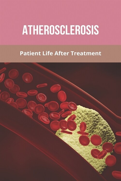 Atherosclerosis: Patient Life After Treatment: Stable Coronary Artery Disease (Paperback)