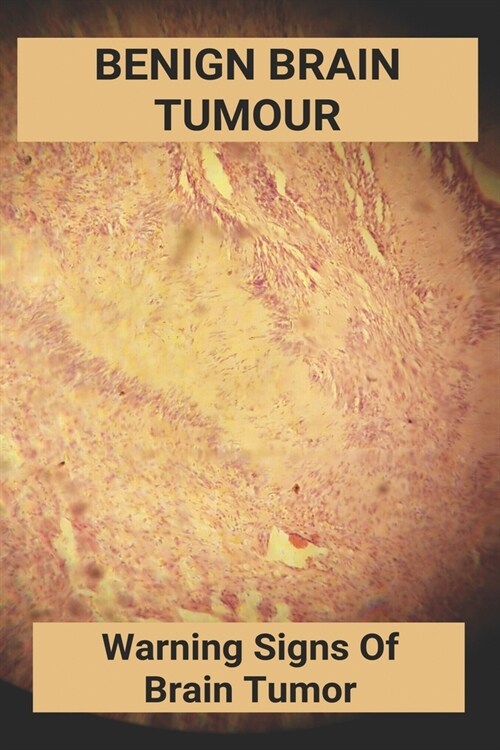 Benign Brain Tumour: Warning Signs Of Brain Tumor: : Colloid Cyst Thyroid Ultrasound (Paperback)