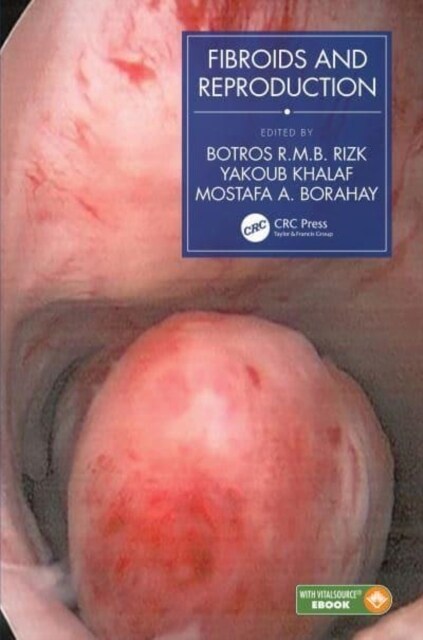 Fibroids and Reproduction (Paperback, 1)