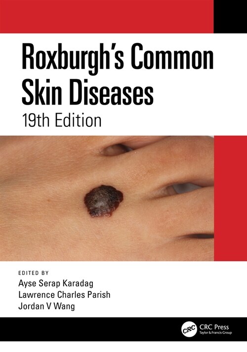 Roxburghs Common Skin Diseases (Paperback, 19 ed)