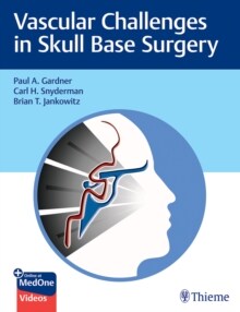 Vascular Challenges in Skull Base Surgery (Hardcover)