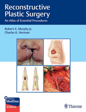 Reconstructive Plastic Surgery: An Atlas of Essential Procedures (Hardcover)