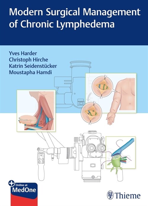 Modern Surgical Management of Chronic Lymphedema (Hardcover)