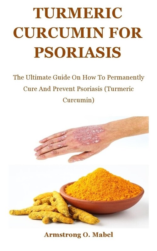 Turmeric Curcumin For psoriasis: The Ultimate Guide On How To Permanently Cure And Prevent Psoriasis (Turmeric Curcumin) (Paperback)