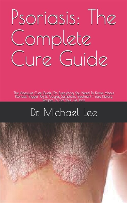 Psoriasis: The Complete Cure Guide: The Absolute Cure Guide On Everything You Need To Know About Psoriasis, Trigger Points, Cause (Paperback)