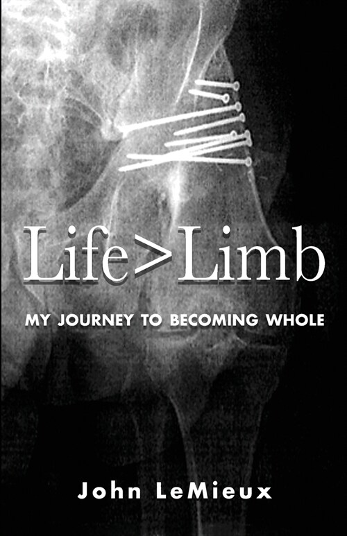 Life is Greater Than Limb: My Journey to Becoming Whole (Paperback)