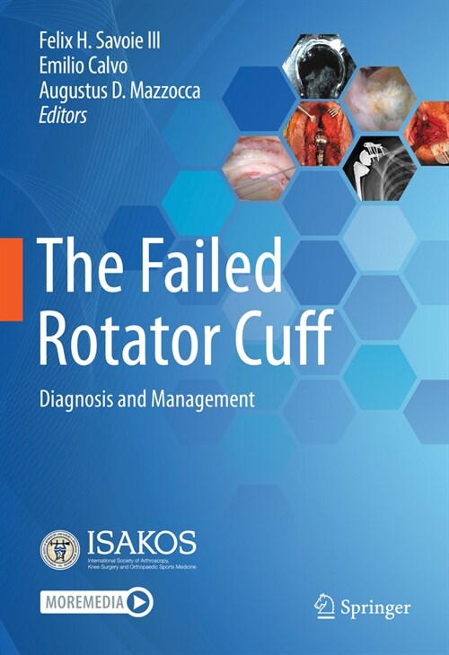 The Failed Rotator Cuff: Diagnosis and Management (Hardcover, 2021)