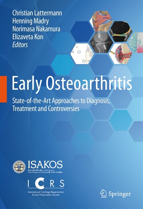 Early Osteoarthritis: State-Of-The-Art Approaches to Diagnosis, Treatment and Controversies (Hardcover, 2022)