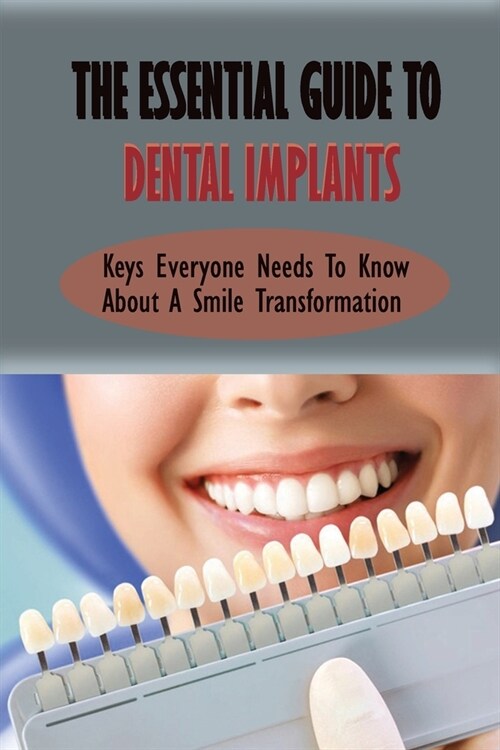 The Essential Guide To Dental Implants: Keys Everyone Needs To Know About A Smile Transformation: Overview Of Current Knowledge And Suggestions For De (Paperback)
