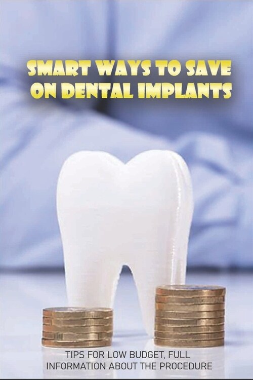 Smart Ways To Save On Dental Implants: Tips For Low Budget, Full Information About The Procedure: Make Informed Decisions Regarding Dental Work (Paperback)