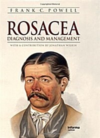 Rosacea (Paperback, 1st)