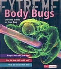 Body Bugs: Uninvited Guests on Your Body (Paperback)