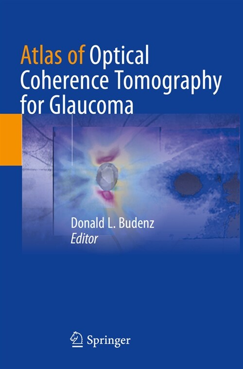 Atlas of Optical Coherence Tomography for Glaucoma (Paperback)