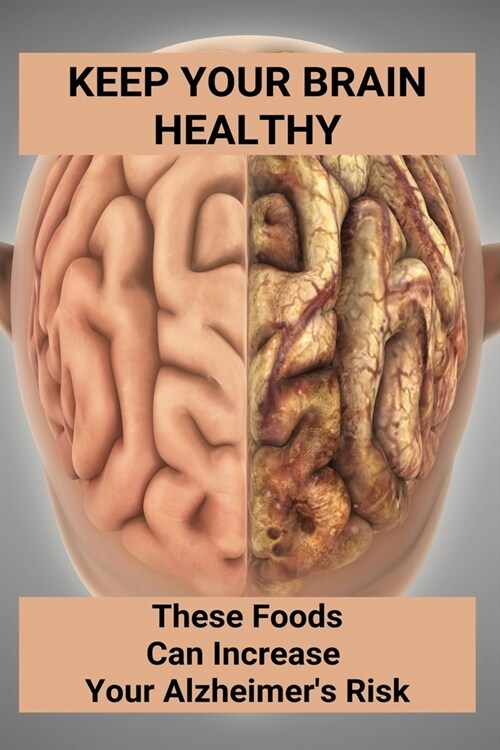 Keep Your Brain Healthy: These Foods Can Increase Your Alzheimers Risk: Brain Development And Healthy (Paperback)