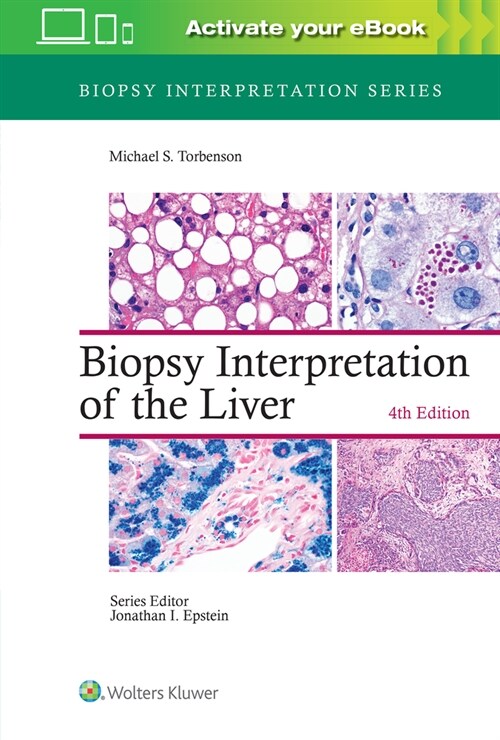 Biopsy Interpretation of the Liver (Hardcover, 4)