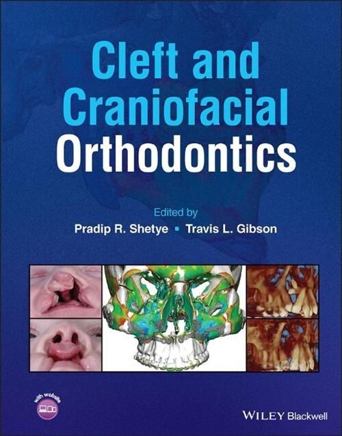 CLEFT AND CRANIOFACIAL ORTHODONTICS (Hardcover)