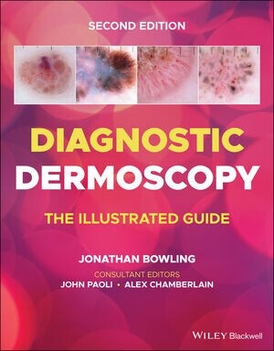 Diagnostic Dermoscopy - The Illustrated Guide, 2e (Paperback)