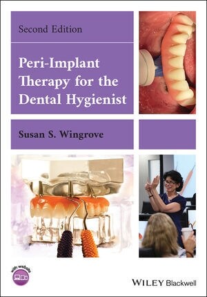 Peri-Implant Therapy for the Dental Hygienist (Paperback, 2)