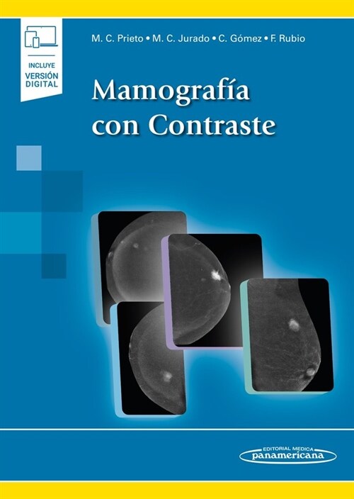 MAMOGRAFIA CON CONTRASTE (Hardcover)