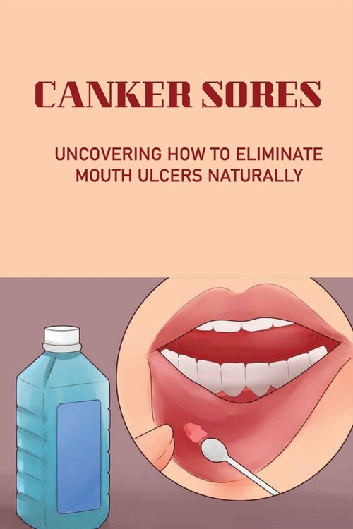 Canker Sores: Uncovering How To Eliminate Mouth Ulcers Naturally: How To Cure Mouth Ulcers Fast Naturally (Paperback)