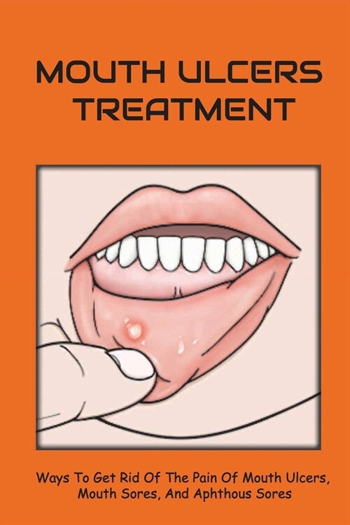 Mouth Ulcers Treatment: Ways To Get Rid Of The Pain Of Mouth Ulcers, Mouth Sores, And Aphthous Sores: Canker Sore In The Throat (Paperback)
