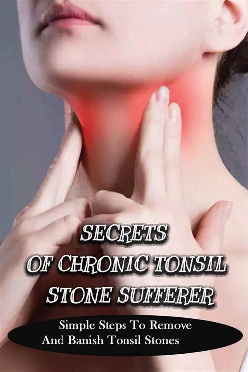 Secrets Of Chronic Tonsil Stone Sufferer: Simple Steps To Remove And Banish Tonsil Stones: How To Get Rid Of Tonsil Stones (Paperback)