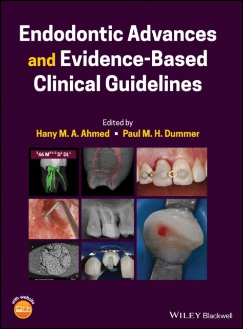 Endodontic Advances and Evidence-Based Clinical Guidelines (Hardcover)