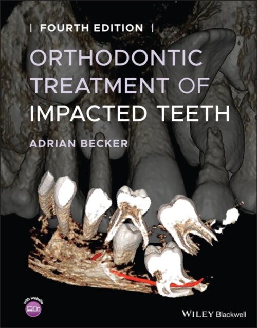 Orthodontic Treatment of Impacted Teeth (Hardcover, 4)