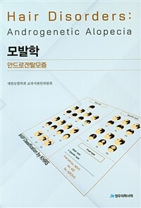 모발학 : 안드로겐탈모증