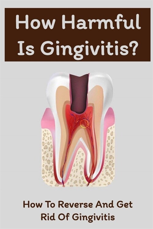 How Harmful Is Gingivitis?: How To Reverse And Get Rid Of Gingivitis: The Health Effects Of Contracting Gingivitis (Paperback)