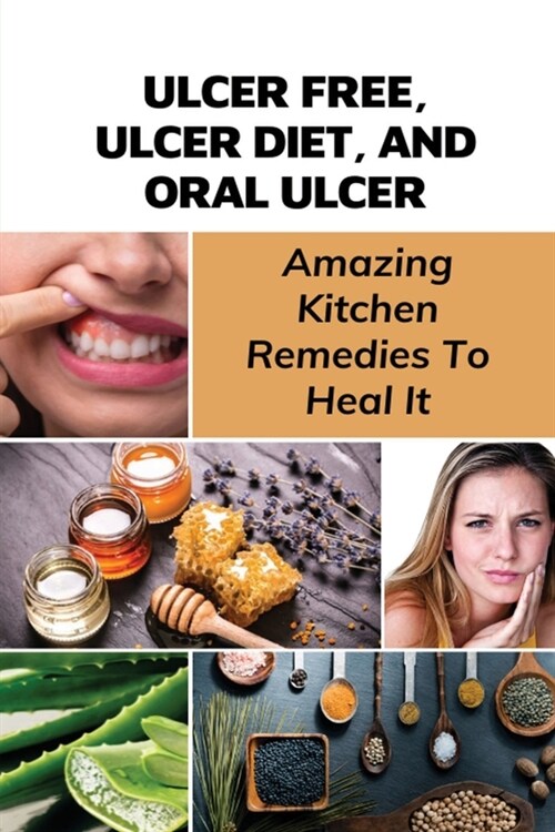 Ulcer Free, Ulcer Diet, And Oral Ulcer: Amazing Kitchen Remedies To Heal It: How Do You Get Rid Of Mouth Ulcers Overnight? (Paperback)
